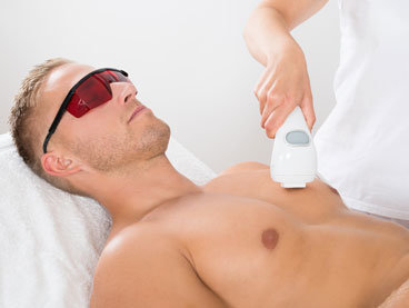 Laser Hair Removal Treatment Areas